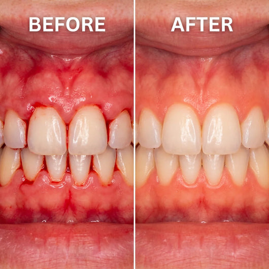 Cougex™ Teeth Whitening & Repair Gel Teeth Repair Pen,Enhances Overall Gums Health