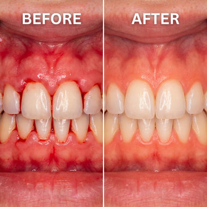 Cougex™ Teeth Whitening & Repair Gel Teeth Repair Pen,Enhances Overall Gums Health