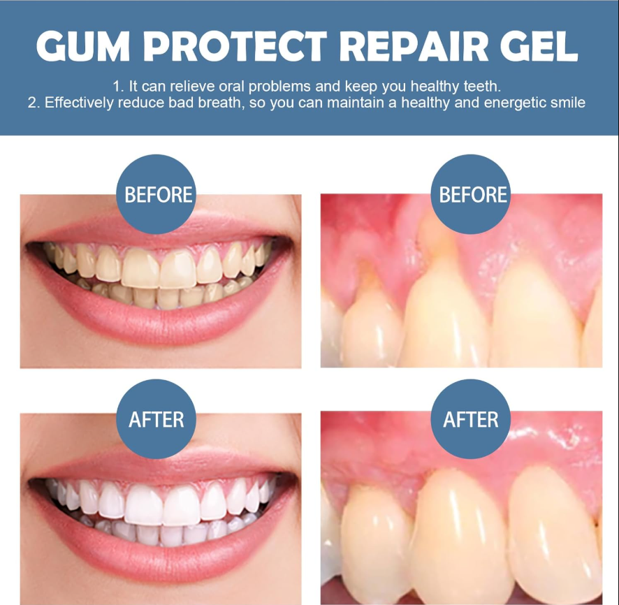 Cougex™ Teeth Whitening & Repair Gel Teeth Repair Pen,Enhances Overall Gums Health